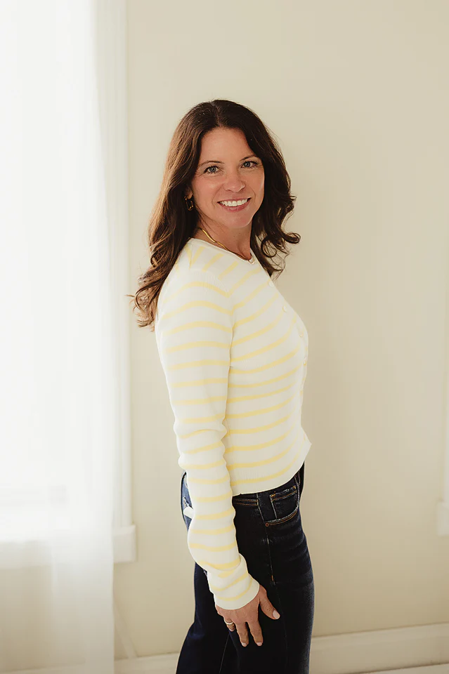 Yellow Simple Striped Cardigan - Image 2